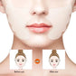 Silicone Anti Wrinkle Patch