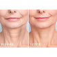 Silicone Anti Wrinkle Patch