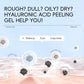 Hyaluronic Acne Repair Cleanser