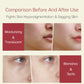 Retinal Tightening Eye Serum